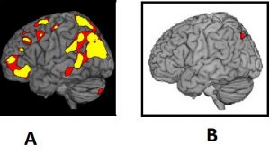 Brain Activity - Past or Future vs Present